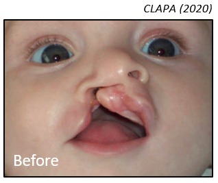 CLAPA photo 1