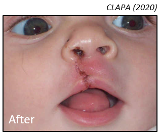 CLAPA photo 2