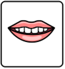Cleft Lip Palate